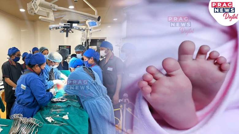 'Foetus in Foeto': 3 Foetuses found in abdomen of 10-month-old boy in Assam