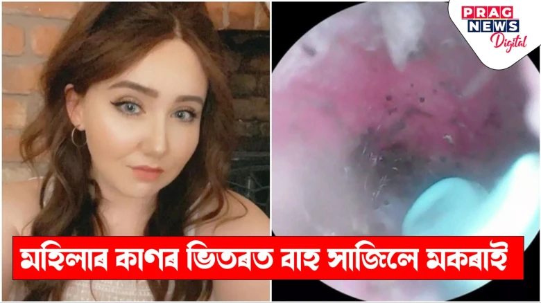 কি যে ঘটনা! মহিলাৰ কাণৰ ভিতৰত বাহ সাজিলে মকৰাই