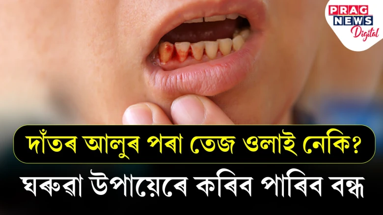 দাঁতৰ আলুৰ পৰা তেজ ওলোৱা বন্ধ কৰক সহজ ঘৰুৱা উপায়েৰে