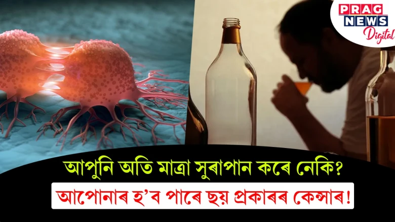 আপুনি অতি মাত্ৰা সুৰাপান কৰে নেকি? আপোনাৰ হ’ব পাৰে ছয় প্ৰকাৰৰ কেন্সাৰ!