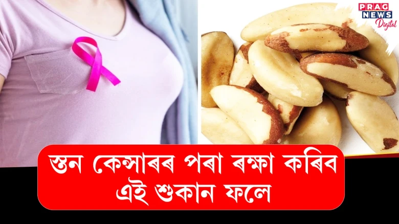 স্তন কেন্সাৰৰ বিৰুদ্ধে বিজ্ঞানীসকলৰ যুঁজ! নতুন আশাৰ সৃষ্টি কৰিছে এক শুকান ফলে