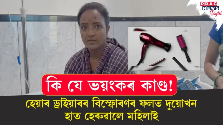 অন কৰোতেই হেয়াৰ ড্ৰাইয়াৰৰ বিস্ফোৰণ! দুয়োখন হাত চিৰদিনলৈ হেৰুৱালে মহিলাই