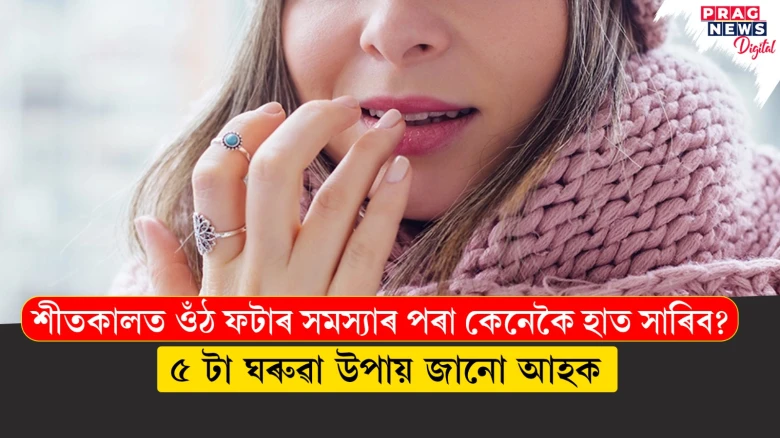 শীতকালত ওঁঠ ফটাৰ সমস্যাৰ পৰা কেনেকৈ হাত সাৰিব ? ৫ টা ঘৰুৱা উপায় জানো আহক