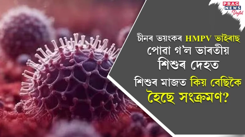 HMPV ভাইৰাছ পোৱা গ’ল তিনিটা ভাৰতীয় শিশুৰ দেহত! ইয়াৰ লক্ষণ কি?