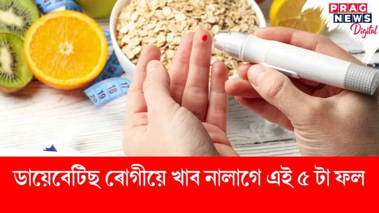 featured post