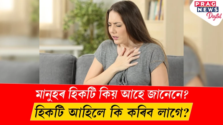 featured post