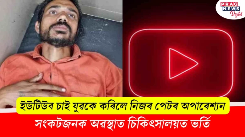 ইউটিউব চাই যুৱকে কৰিলে নিজৰ পেটৰ অপাৰেশ্যন